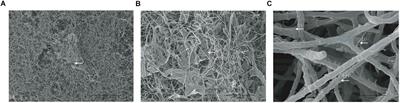 <mark class="highlighted">In vitro Evaluation</mark> of Photodynamic Effects Against Biofilms of Dermatophytes Involved in Onychomycosis
